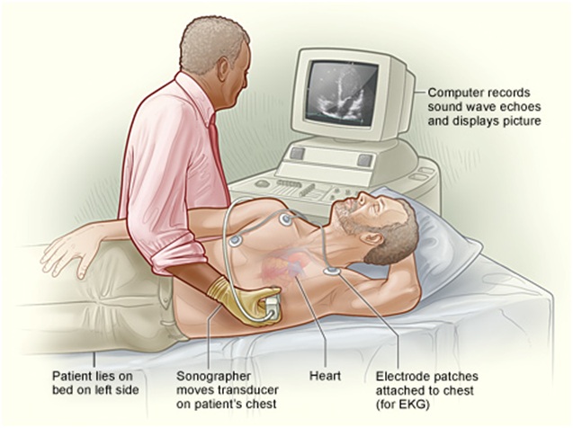 Transthoracic Echocardiography